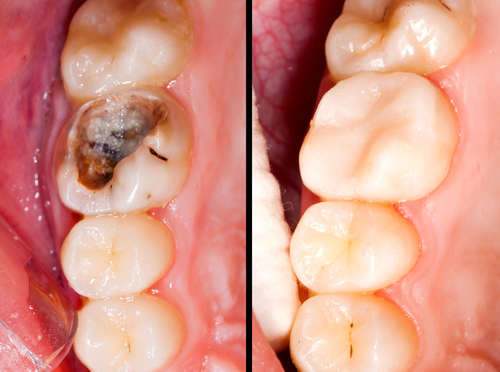 dentiste bois-guillaume
