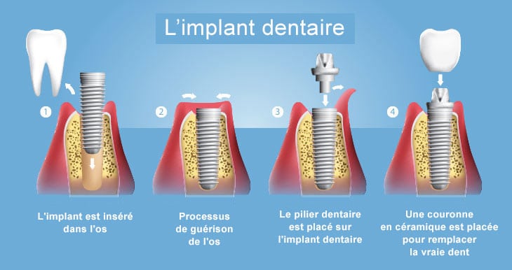 Docteur Cauchois Sandrine - Dentiste Bois-Guillaume
